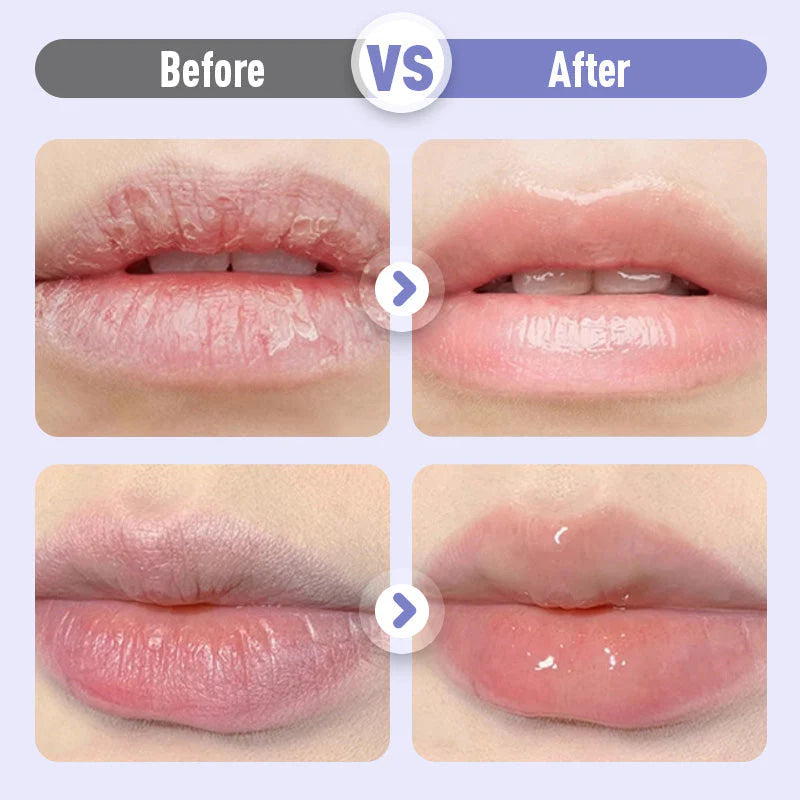 Plumping & Anti-Wrinkle Lip Serum |2Pcs