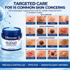 7-Day Skin Tag Eraser Cream