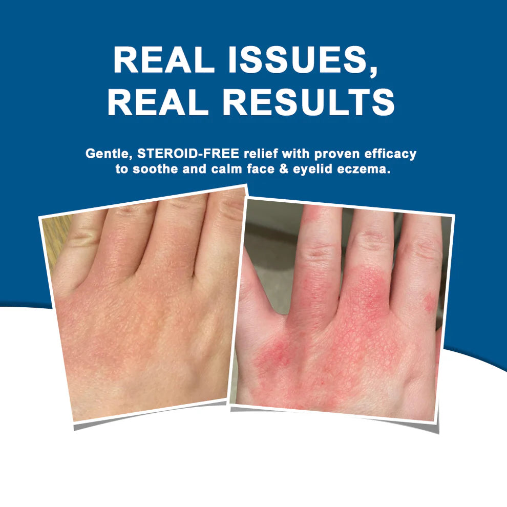 Grahams Natural Skin C+ Eczema & Dermatitis Relief Cream