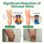 VeinEase Overnight Therapy Patch