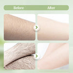 Gentle Hair Removal Cream