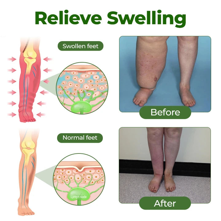 Leg Circulation Cream