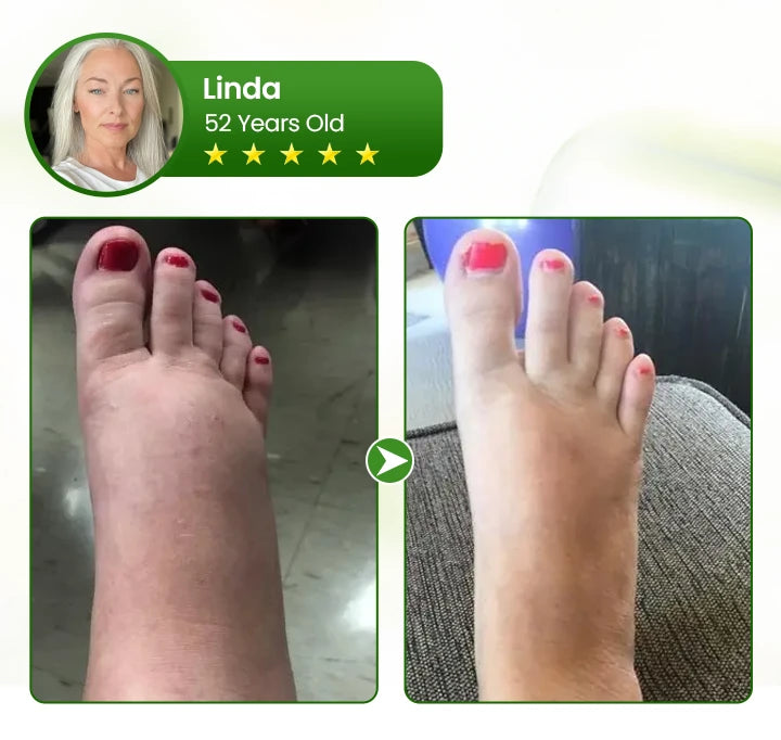 Leg Circulation Cream