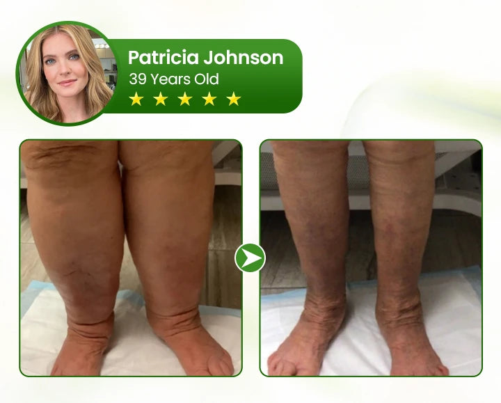 Leg Circulation Cream