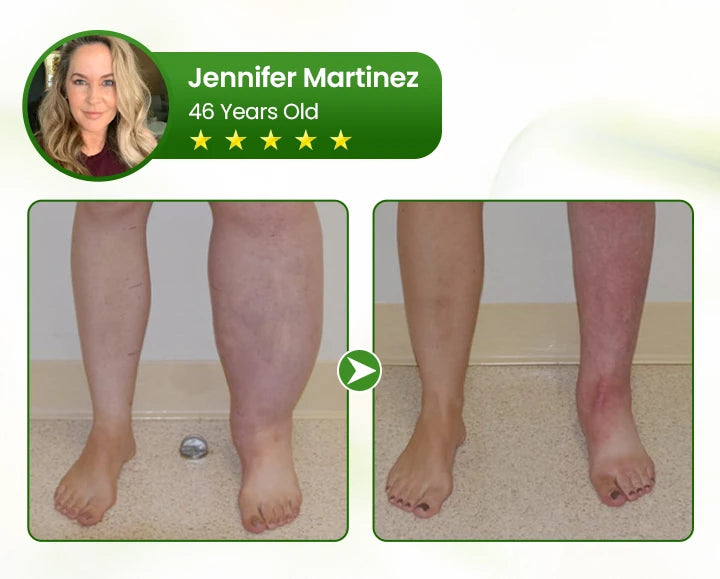 Leg Circulation Cream