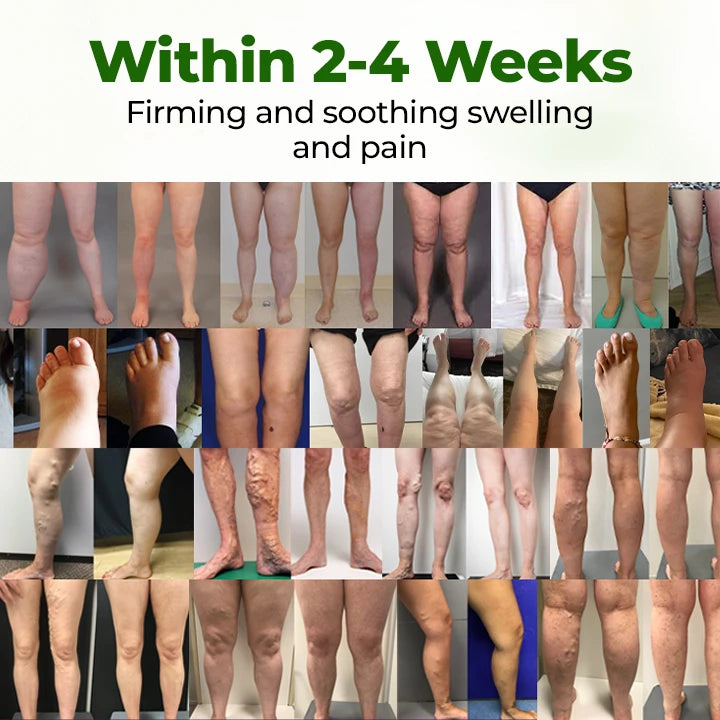 Leg Circulation Cream