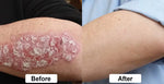 Beef Tallow Itch Relief Spray