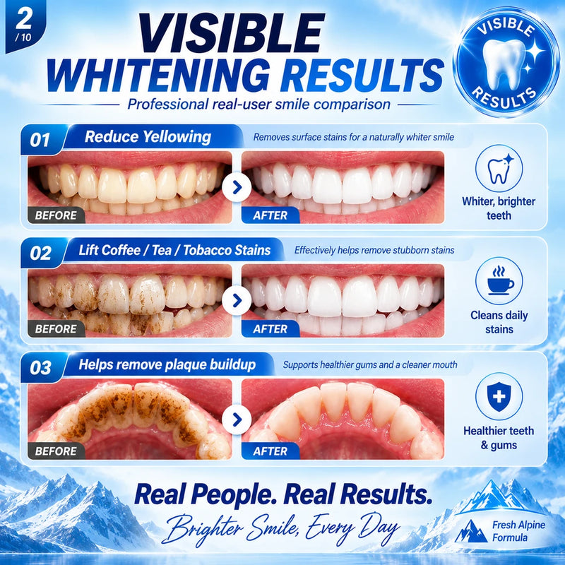 Foam Bright Whitening Foaming Toothpaste