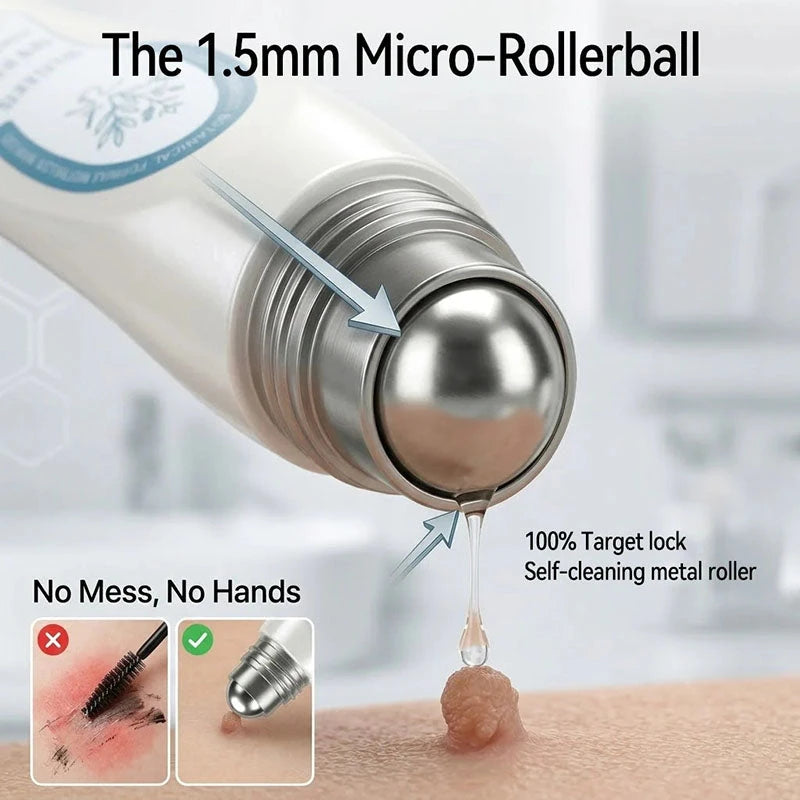 Pure Skin Spot Removal Roller