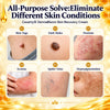 Mirevane Skin Recovery Gel