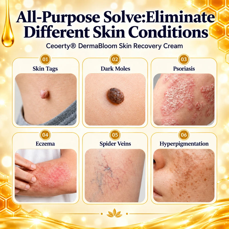 Mirevane Skin Recovery Gel