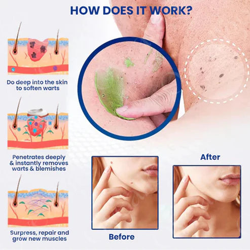 Fivfivgo™ NatureErase Mole & Spot Cream