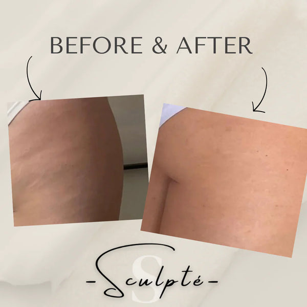 Sculpte Body Toning Device