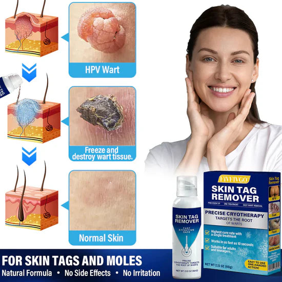 Fivfivgo® TagRecede Cryo Spray| Fast Skin Tag Remover