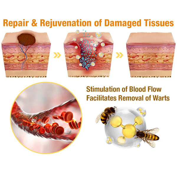 Bee poison treatment spray