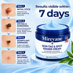 7-Day Skin Tag Eraser Cream