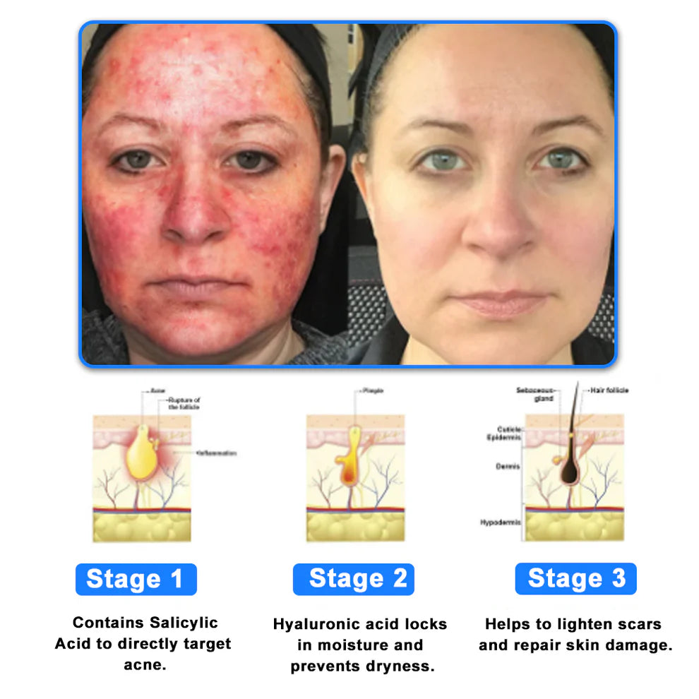 Grahams Natural Skin C+ Eczema & Dermatitis Relief Cream