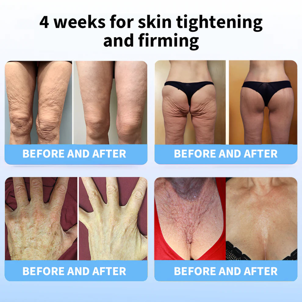 LOVILDS 𝐀𝐝𝐯𝐚𝐧𝐜𝐞𝐝 𝐅𝐢𝐫𝐦𝐢𝐧𝐠 & 𝐖𝐫𝐢𝐧𝐤𝐥𝐞-𝐑𝐞𝐝𝐮𝐜𝐢𝐧𝐠 𝐂𝐫𝐞𝐚𝐦