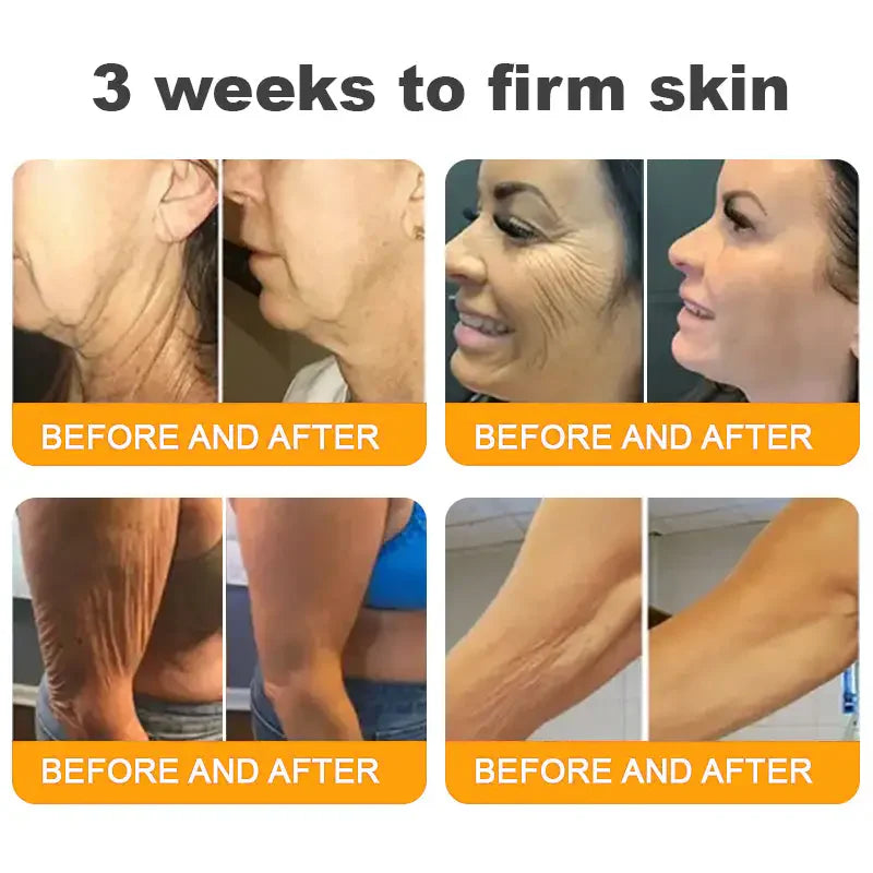 Bee Venom Skin Restoration Cream