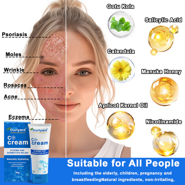 Grahams Natural Skin C+ Eczema & Dermatitis Relief Cream