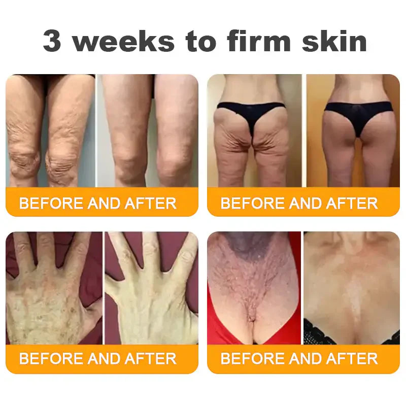 Bee Venom Skin Restoration Cream