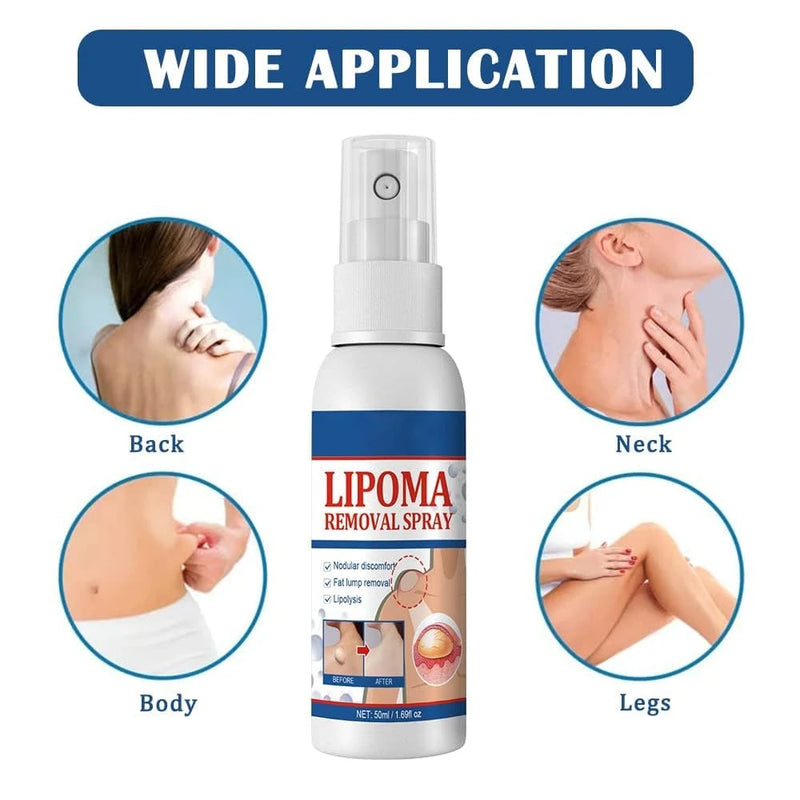 Herbal Lipoma Reduction Spray