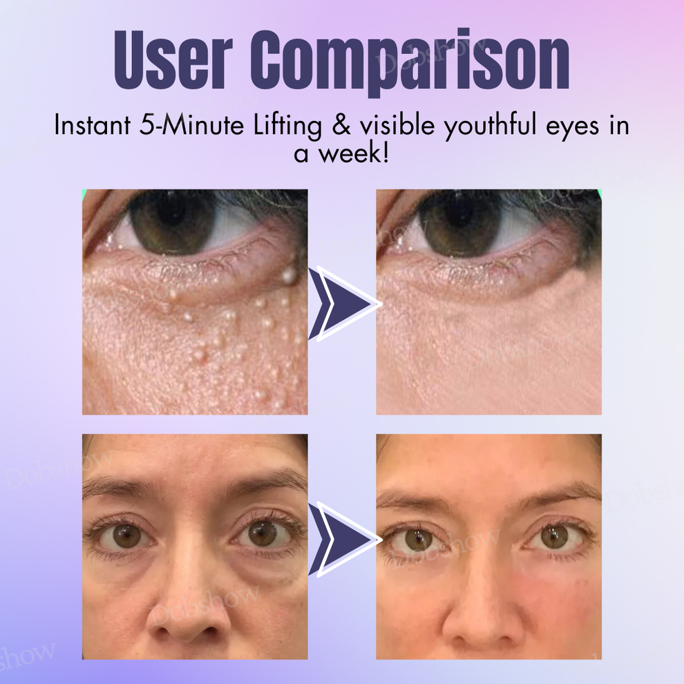 Collagen+ Bee Venom Eye Cream Roll On