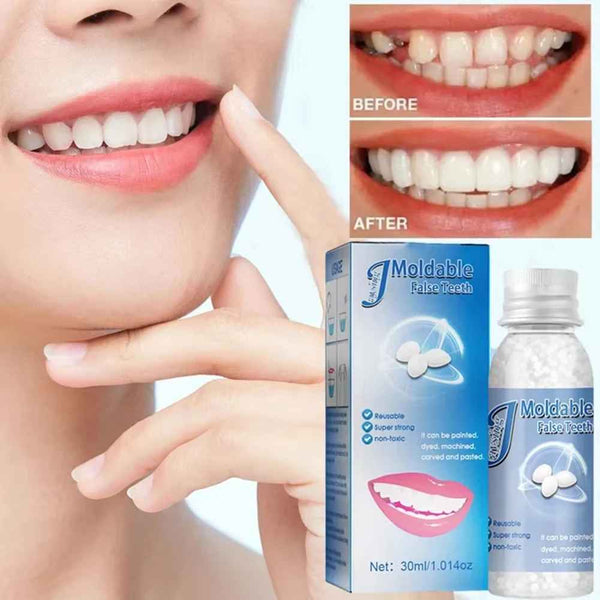 SmileFix Natural Tooth Repair Kit