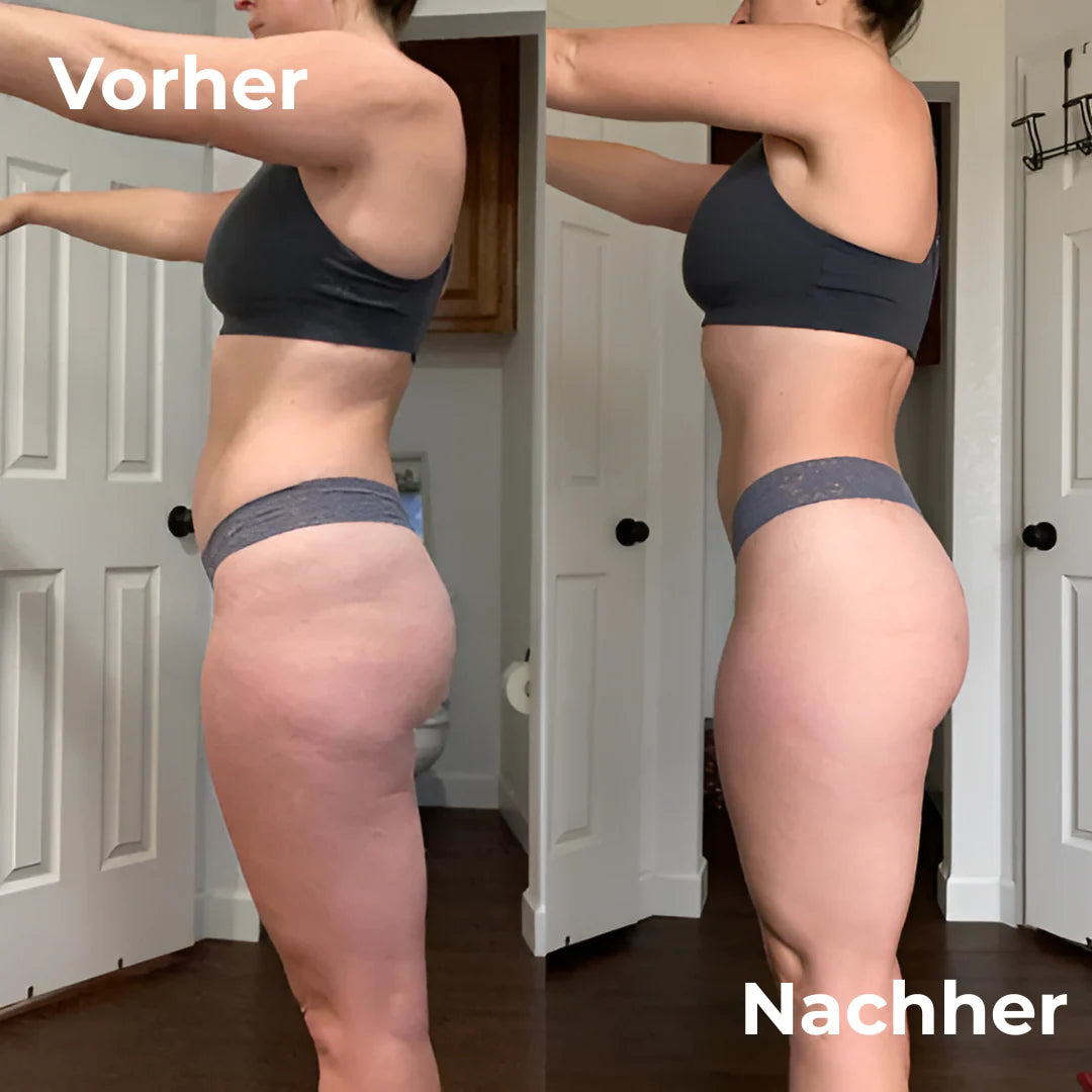 Sculptroll™ | Cellulite roller